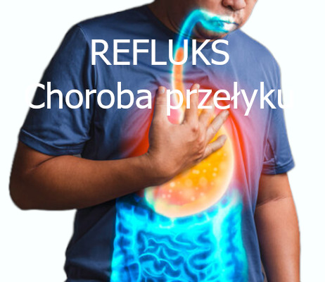 Refluks - choroba przełyku